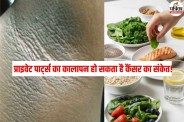 Acanthosis Nigricans symptoms, Neck darkening skin disease, Skin dark patches cancer warning acanthosis nigricans meaning