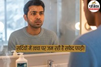 Winter skin diseases doctor advice, Seborrheic Dermatitis symptoms