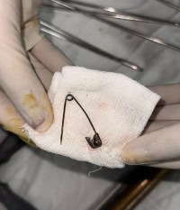 Ahmedabad civil hospital