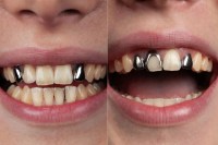 प्रतीकात्मक तस्वीर, मेटा एआइ