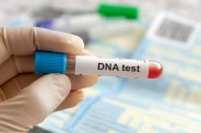 DNA Test