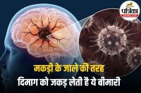 Glioblastoma Brain Cancer