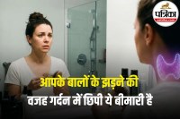 Hyperthyroidism Hair Loss