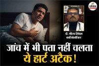 Mini Heart Attack, Mini Heart Attack Symptoms, A Famous Cardiologist, mini heart attack ke lakshan,