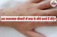 Skin Disease