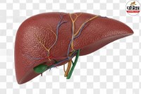 fatty liver