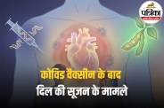 mRNA Vaccine