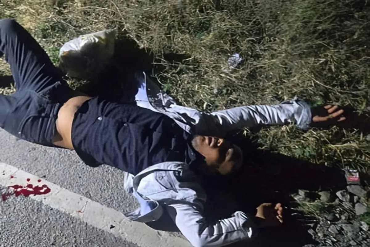 लखनऊ में पुलिस-बदमाश मुठभेड़: बैंक मैनेजर की पत्नी से लूट करने वाला आरोपी गोली लगने से घायल