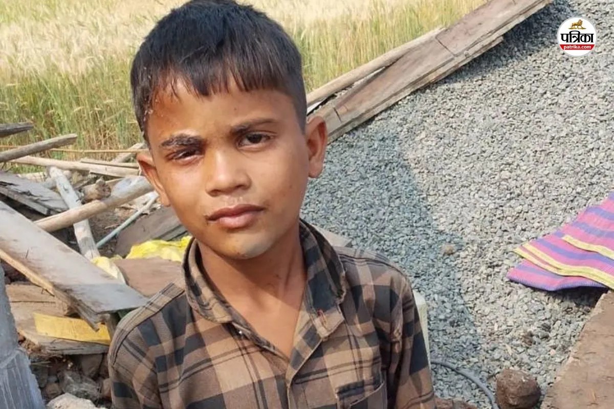 Banswara student eyelids were glued together with Fevikwik family worried