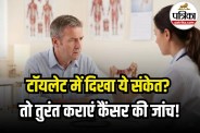 Colon Cancer Early Symptoms