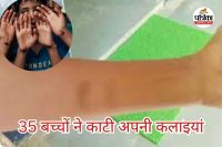 35 बच्चों की कटी कलाइयां (photo source- Patrika)