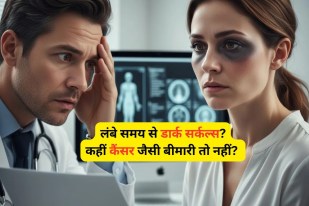 Dark Circles Cancer Symptom, Dark Circles sign, dark circles under eyes