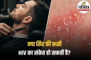 HIV Skin Symptoms