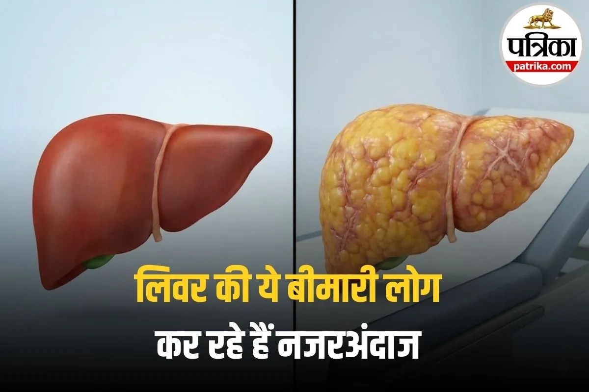 Liver Fibrosis Symptoms