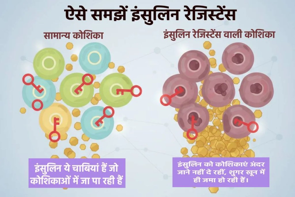 MP News Diabetes Reversible Episode 5 Insulin Resistance