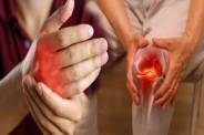 Arthritis