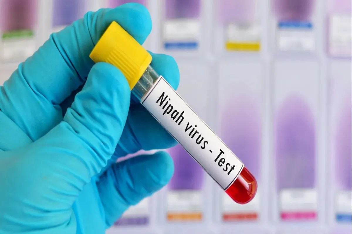 Nipah Virus