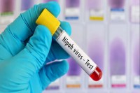 Nipah Virus