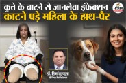 pet dog lick turns deadly, Woman loses both hands and legs, Doctor Explain sepsis infection,