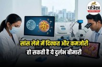 Pompe Disease Symptoms