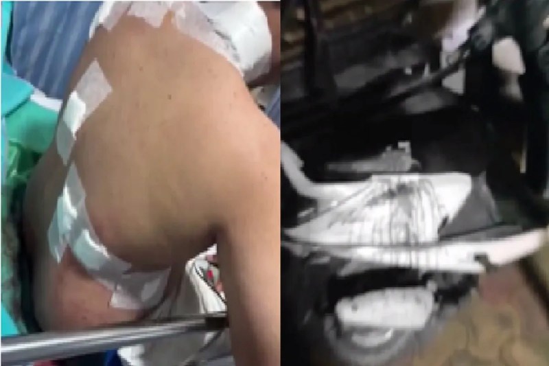 Crime News, congress leader son injured