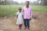 Surgery Performed on the Girl’s Eyes