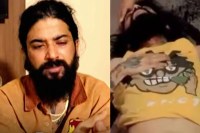 Anurag Dobhal serious after suicide attempt doctor sais youtuber neck hip and bone are damage