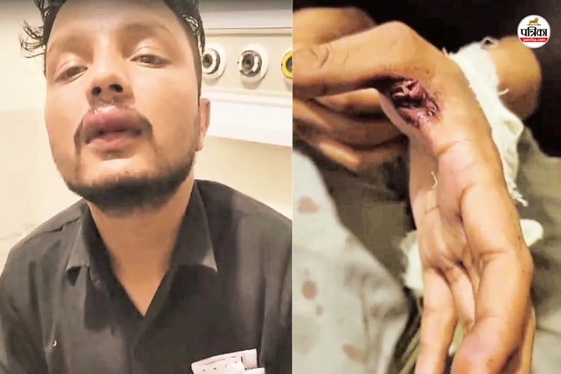 हमले में घायल शोरूम कर्मचारी, पत्रिका फोटो