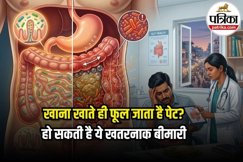 Gas and Bloating Problem