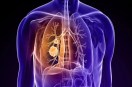 Lung Cancer