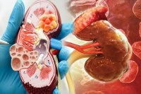 Child's Kidney Damaged