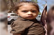 Jhalawar Medical College, Rare Spine Surgery, 3 Year Old Child Surgery, Spinal Cord Surgery India, Pediatric Neurosurgery, Rare Birth Defect Treatment, Double Cord Syndrome, Complex Spine Operation, Rajasthan Medical News, Successful Surgery India, Neurosurgery Teamwork, Spinal Deformity Treatment, Child Health Surgery, Government Medical College Surgery, Rajasthan Healthcare News