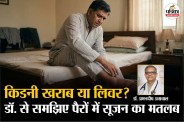 Swollen Feet In Morning, Swollen Feet In Morning Cause, liver disease sign,