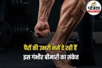 Vein Health Tips