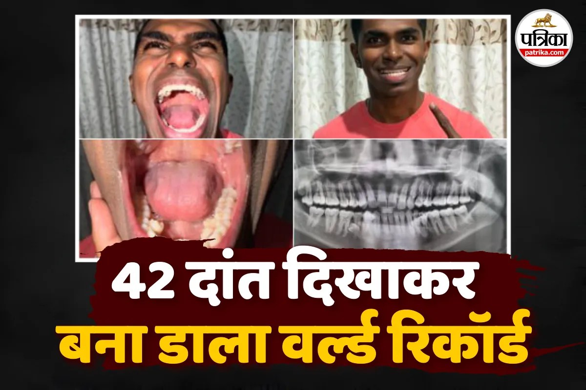 The Man With Too Many Smiles