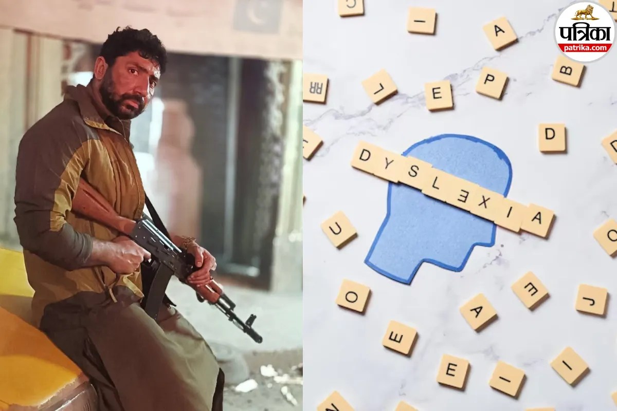 Dhurandhar 2 actor Rizwan dyslexia