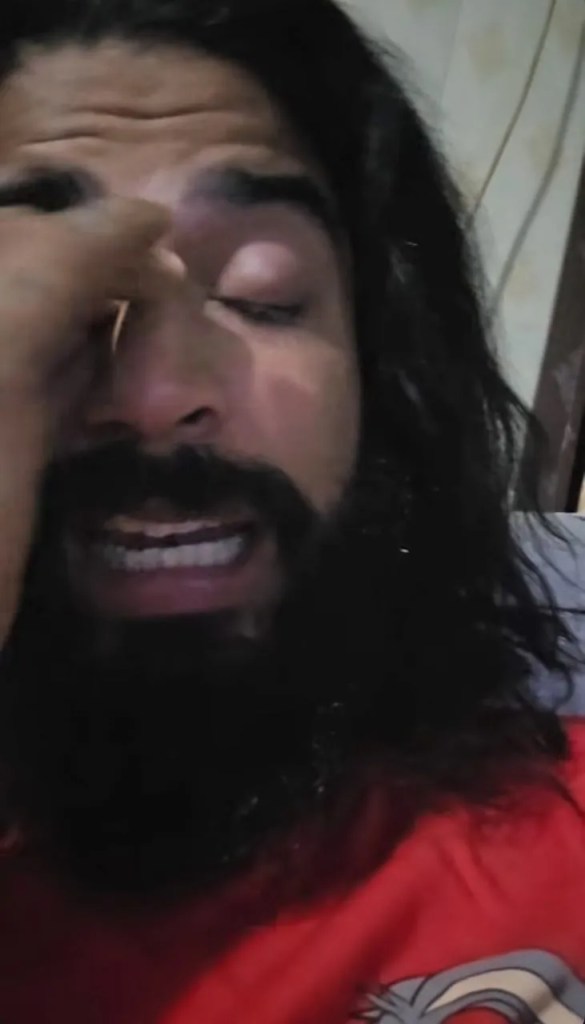 Anurag Dobhal Suicide Attempt