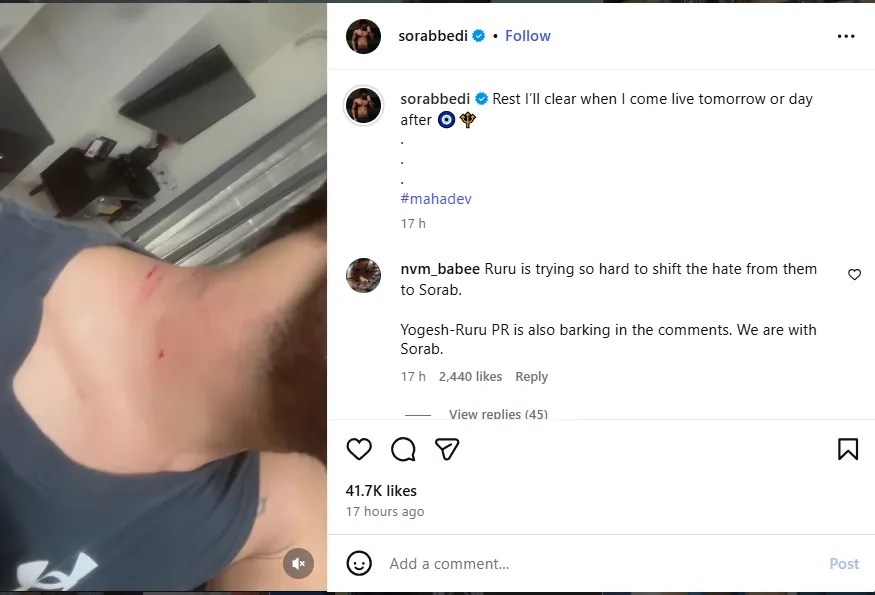 Sorab Bedi Cheating Controversy