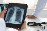 TB patients