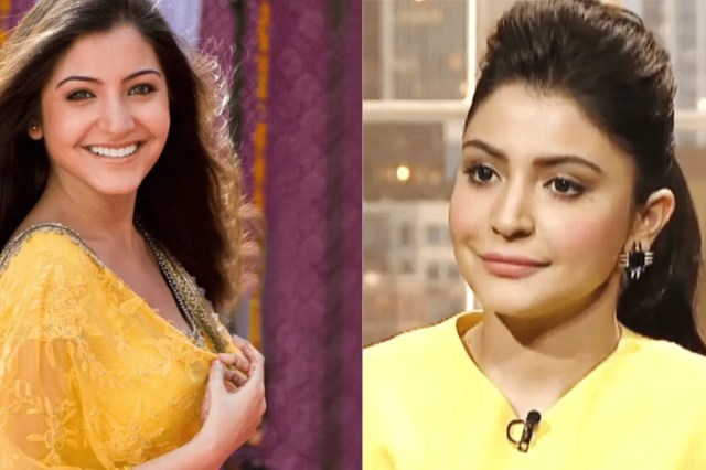 Bollywood Actresses Plastic Surgery