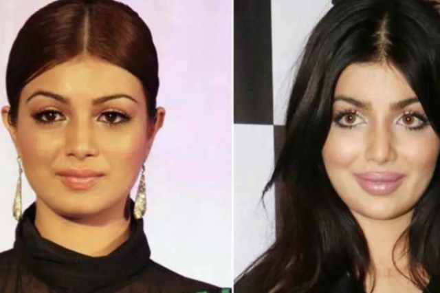 Bollywood Actresses Plastic Surgery