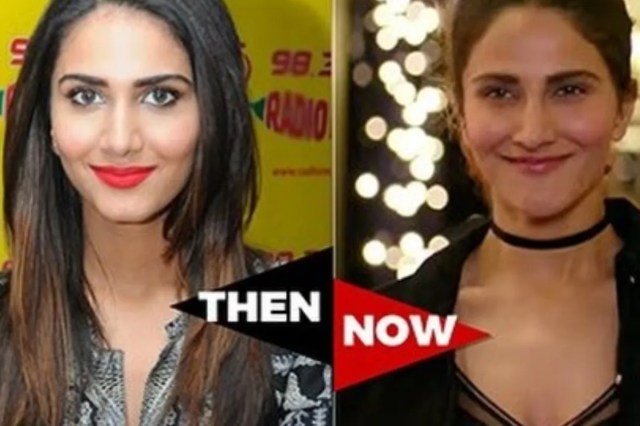 Bollywood Actresses Plastic Surgery