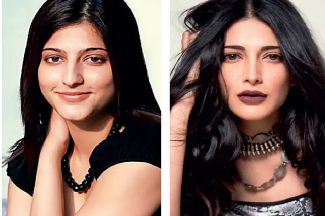 Bollywood Actresses Plastic Surgery