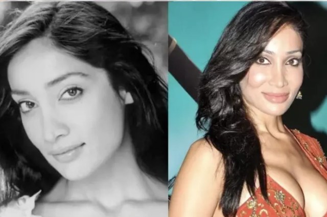 Bollywood Actresses Plastic Surgery