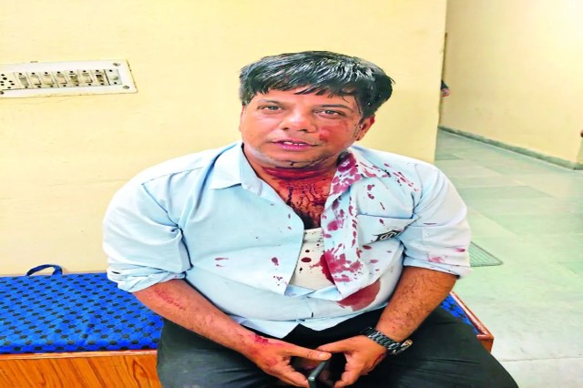 कचौरी को लेकर बार में बवाल, होटल स्टाफ और ग्राहकों में जमकर मारपीट