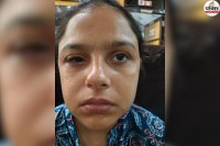 Jaipur Private Hospital Doctor Operates on Right Eye Instead of Left