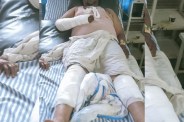 BJP Leader Attack