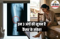Bone Cancer Symptoms