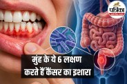 Gum Disease and Colon Cancer