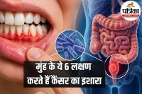 Gum Disease and Colon Cancer